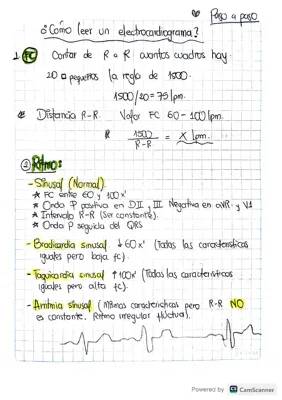 Cómo Leer un Electrocardiograma Fácil para Niños: Valores Normales, Anormales y Ritmo Sinusal