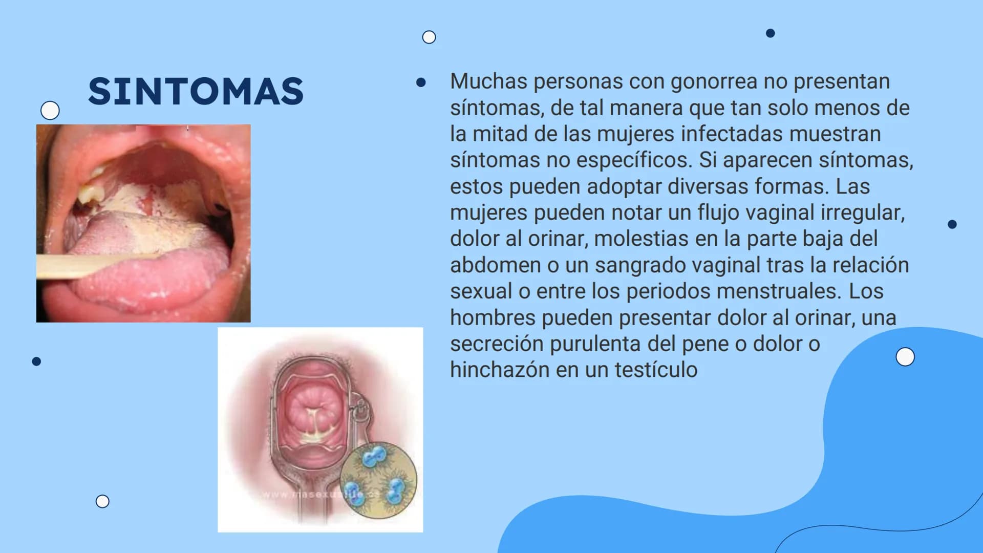 ENFERMEDADES
DE ETRASMICION
SEXUAL
ETS
0
+00000 +00000
¿QUE SON?
Las enfermedades de trasmisión sexual, o infecciones
de trasmisión sexual (