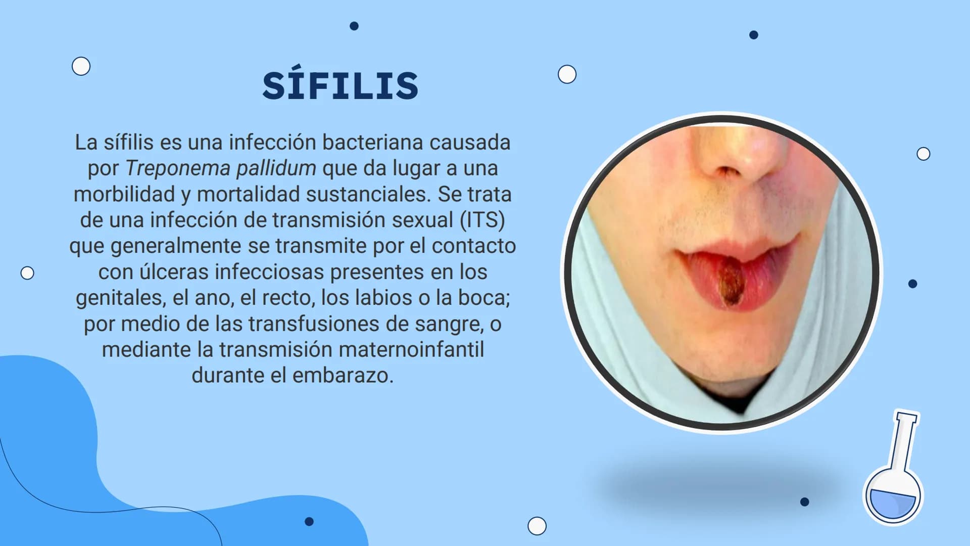 ENFERMEDADES
DE ETRASMICION
SEXUAL
ETS
0
+00000 +00000
¿QUE SON?
Las enfermedades de trasmisión sexual, o infecciones
de trasmisión sexual (
