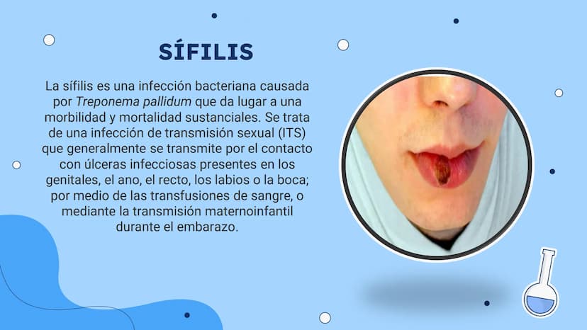 ENFERMEDADES
DE ETRASMICION
SEXUAL
ETS
0
+00000 +00000
¿QUE SON?
Las enfermedades de trasmisión sexual, o infecciones
de trasmisión sexual (