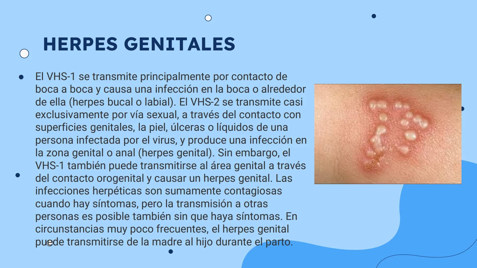 ENFERMEDADES
DE ETRASMICION
SEXUAL
ETS
0
+00000 +00000
¿QUE SON?
Las enfermedades de trasmisión sexual, o infecciones
de trasmisión sexual (