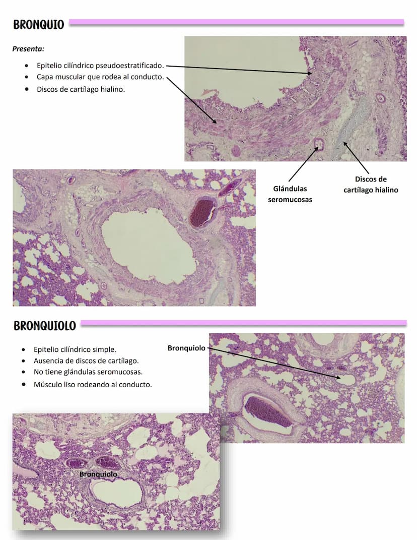 LENGUA
SISTEMA DIGESTIVO
Se constituye de 27 músculos
Capas:
MUCOSA:
Epitelio plano
estratificado no
queratinzado
Lámina propia:
T.C. denso
