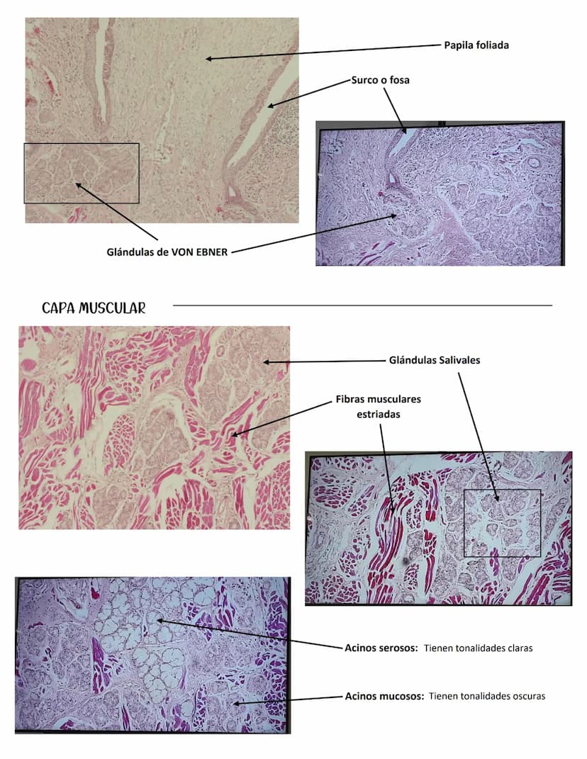 LENGUA
SISTEMA DIGESTIVO
Se constituye de 27 músculos
Capas:
MUCOSA:
Epitelio plano
estratificado no
queratinzado
Lámina propia:
T.C. denso
