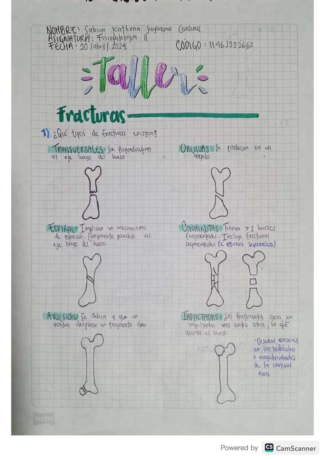 NOMBRE: Sahian Katherin Jaganume Cardinal
ASIGNATURA: Fisiopatologia ||
FECHA 20 (ab1| 2024.
CODIGO : 11462222662
= Taller
Fracturas-
1). ¿Q