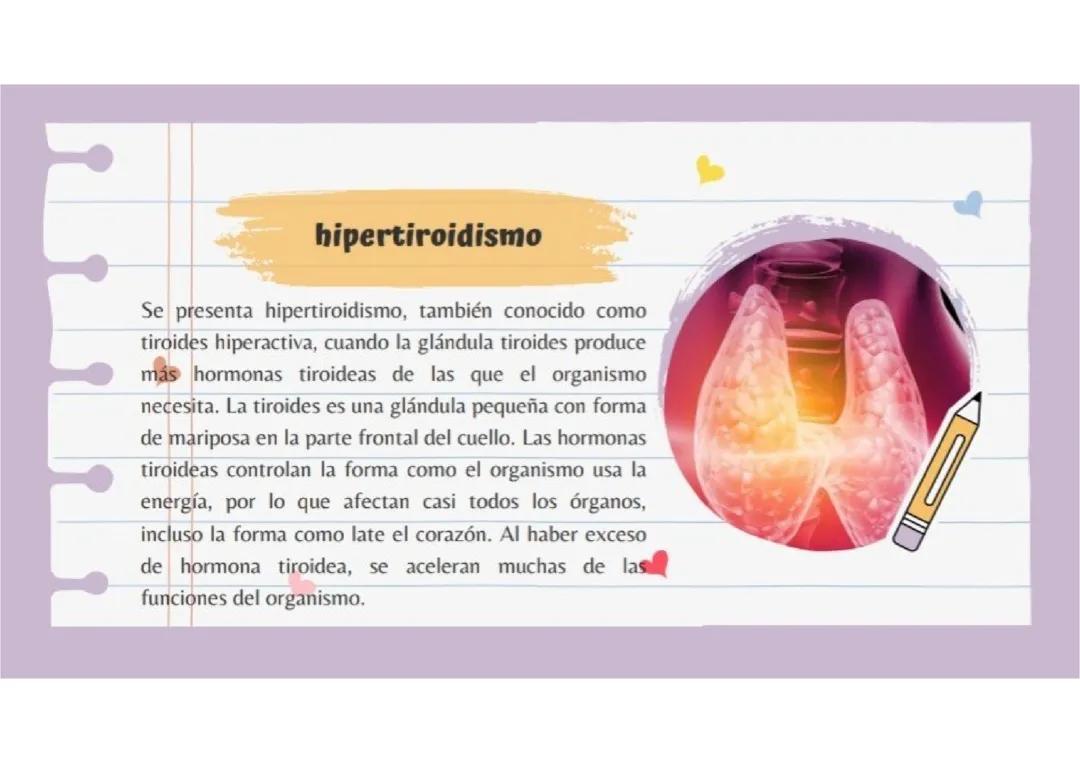 Descubre el Hipertiroidismo: Función y Cuidado