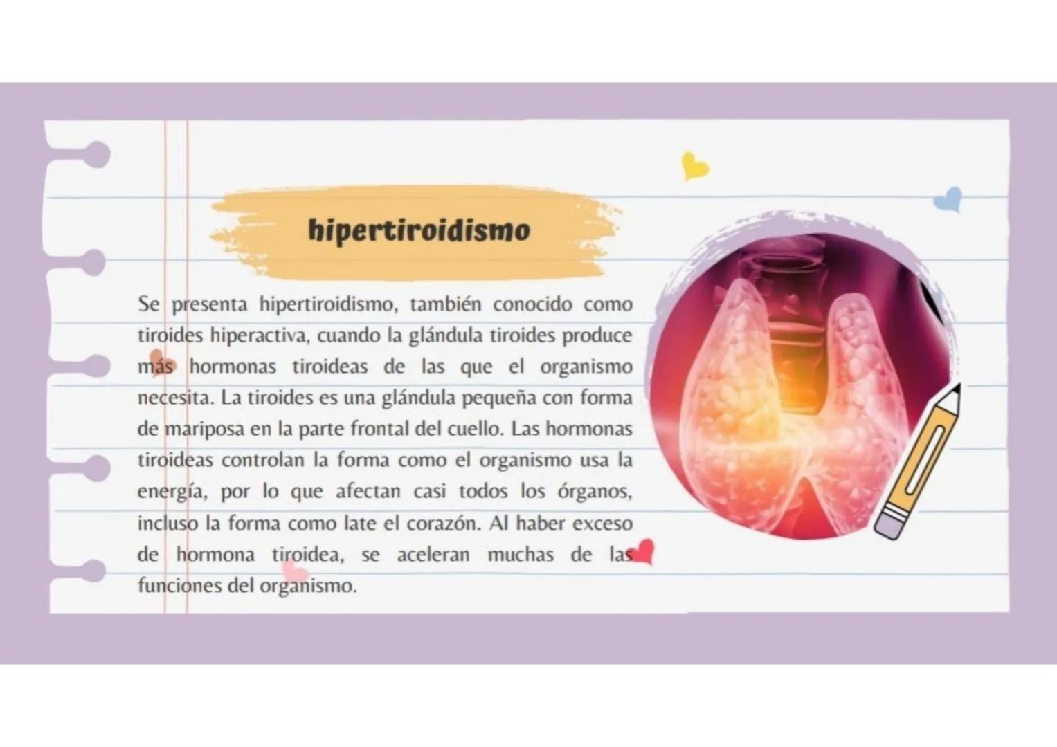 hipertiroidismo
Se presenta hipertiroidismo, también conocido como
tiroides hiperactiva, cuando la glándula tiroides produce
más hormonas ti