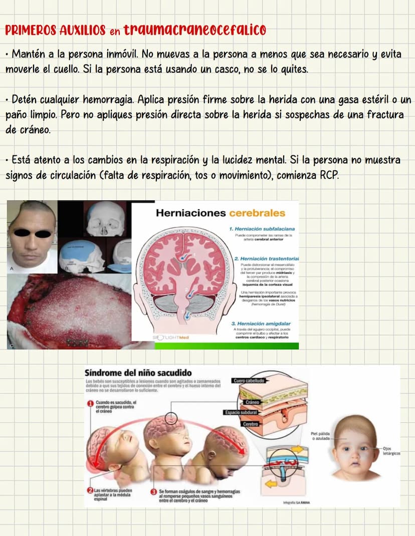 PRIMEROS
AUXILIOS Primeros auxILIOS
Los primeros auxilios son muy importantes, ya que de los
primeros minutos dependerá el pronóstico de la 