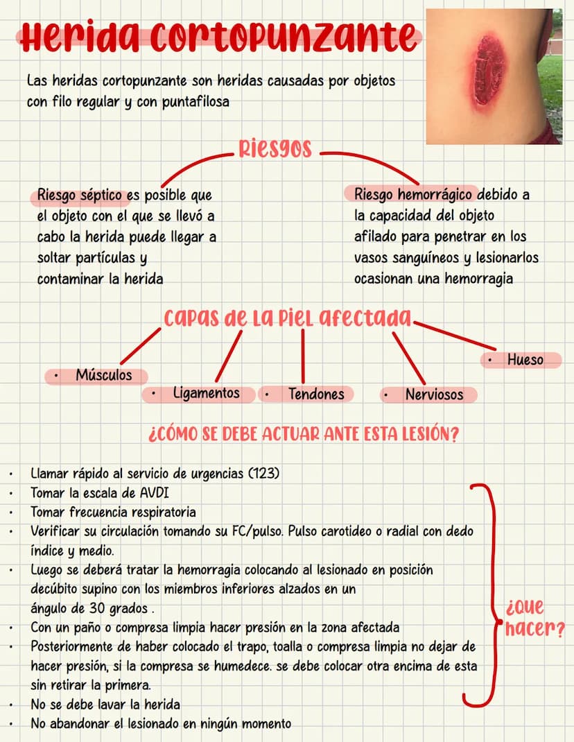 PRIMEROS
AUXILIOS Primeros auxILIOS
Los primeros auxilios son muy importantes, ya que de los
primeros minutos dependerá el pronóstico de la 