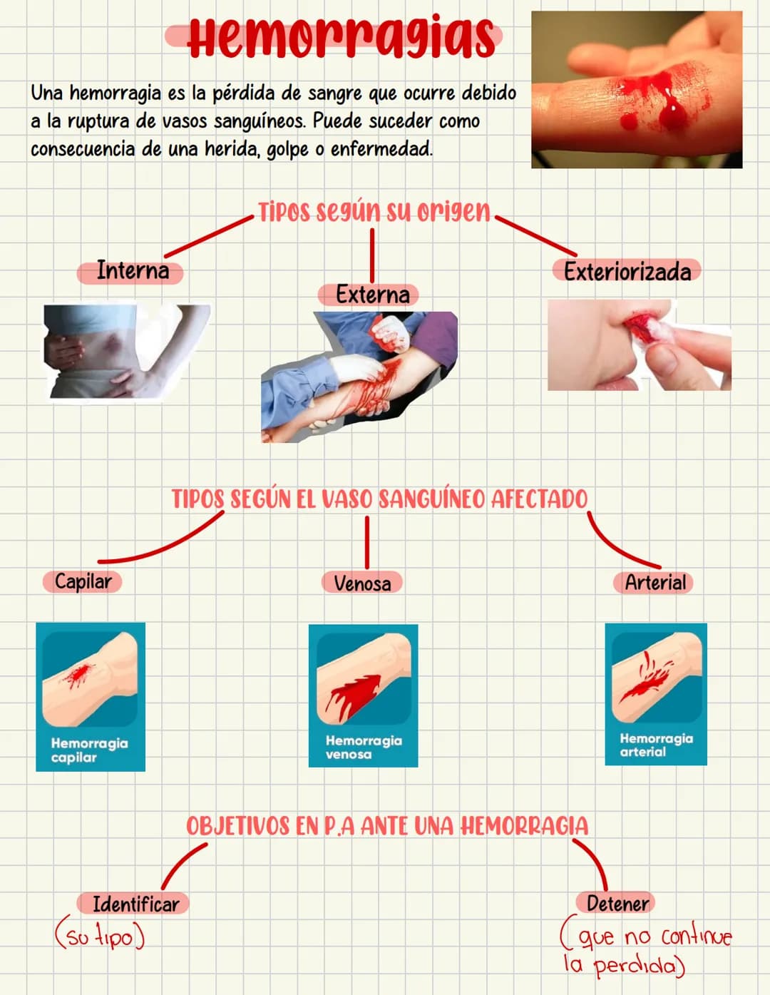 PRIMEROS
AUXILIOS Primeros auxILIOS
Los primeros auxilios son muy importantes, ya que de los
primeros minutos dependerá el pronóstico de la 