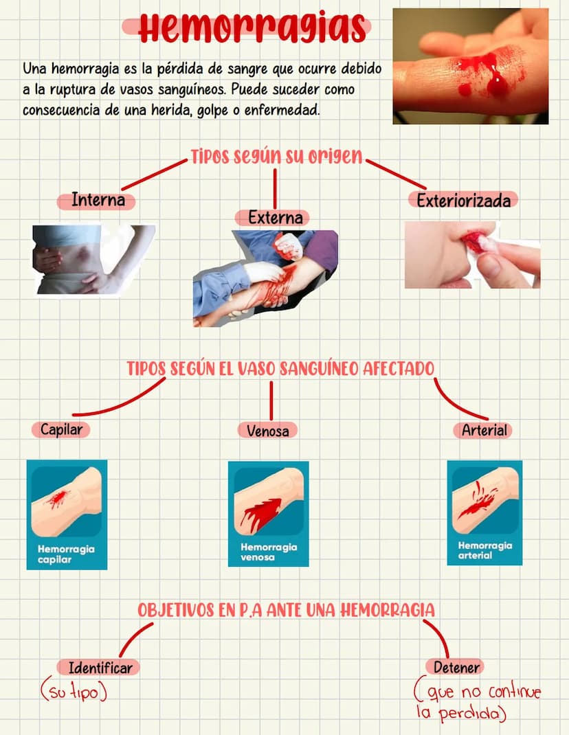 PRIMEROS
AUXILIOS Primeros auxILIOS
Los primeros auxilios son muy importantes, ya que de los
primeros minutos dependerá el pronóstico de la 