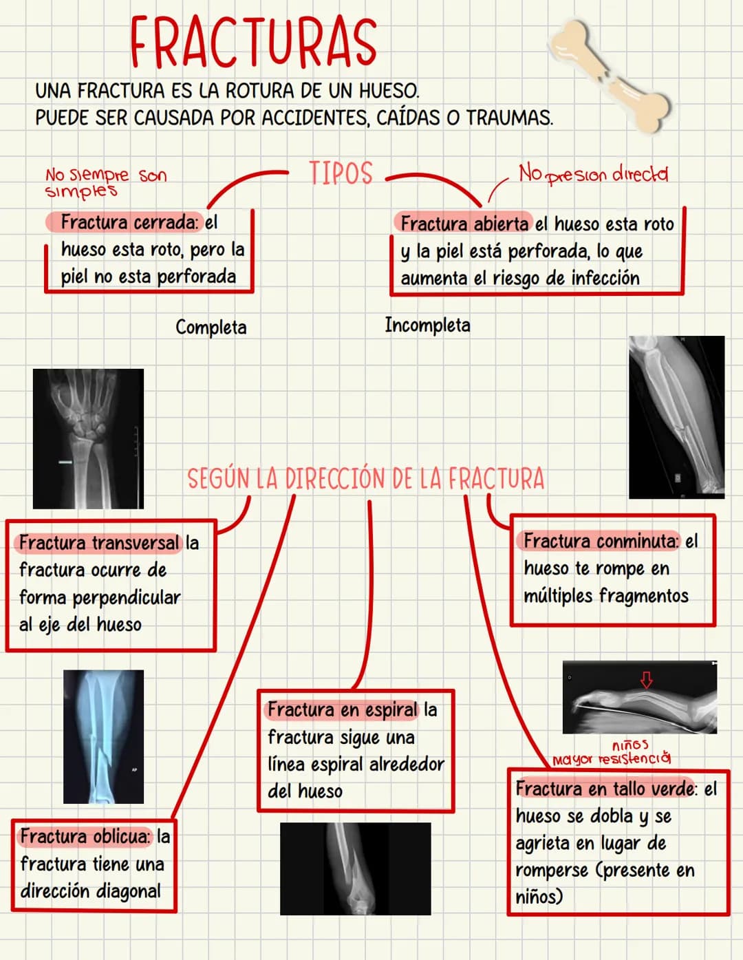 PRIMEROS
AUXILIOS Primeros auxILIOS
Los primeros auxilios son muy importantes, ya que de los
primeros minutos dependerá el pronóstico de la 