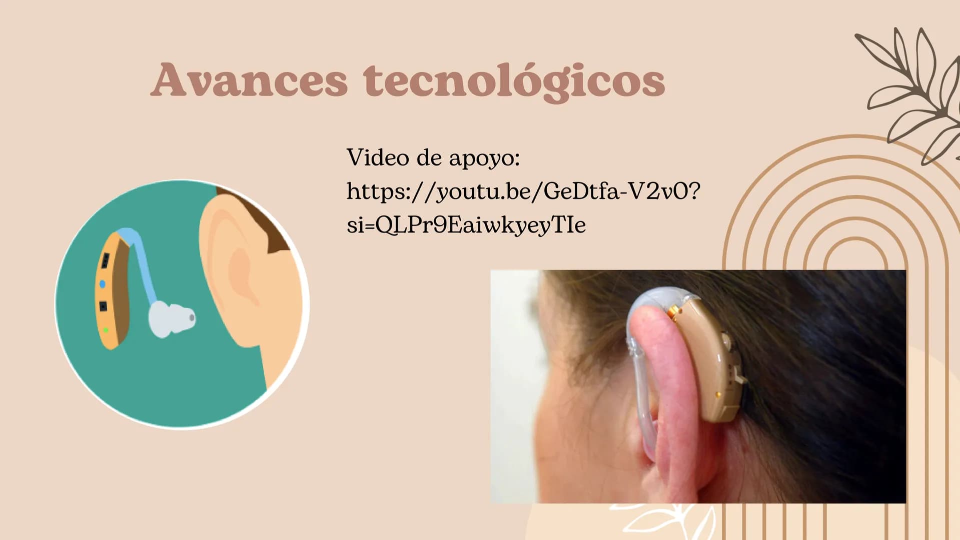 Discapacidad
Auditiva Hablaremos de:
• ¿Cuál es el sentido de audición?
• ¿Por qué se pierde este sentido?
. Adquirido o congénito
• Partes 