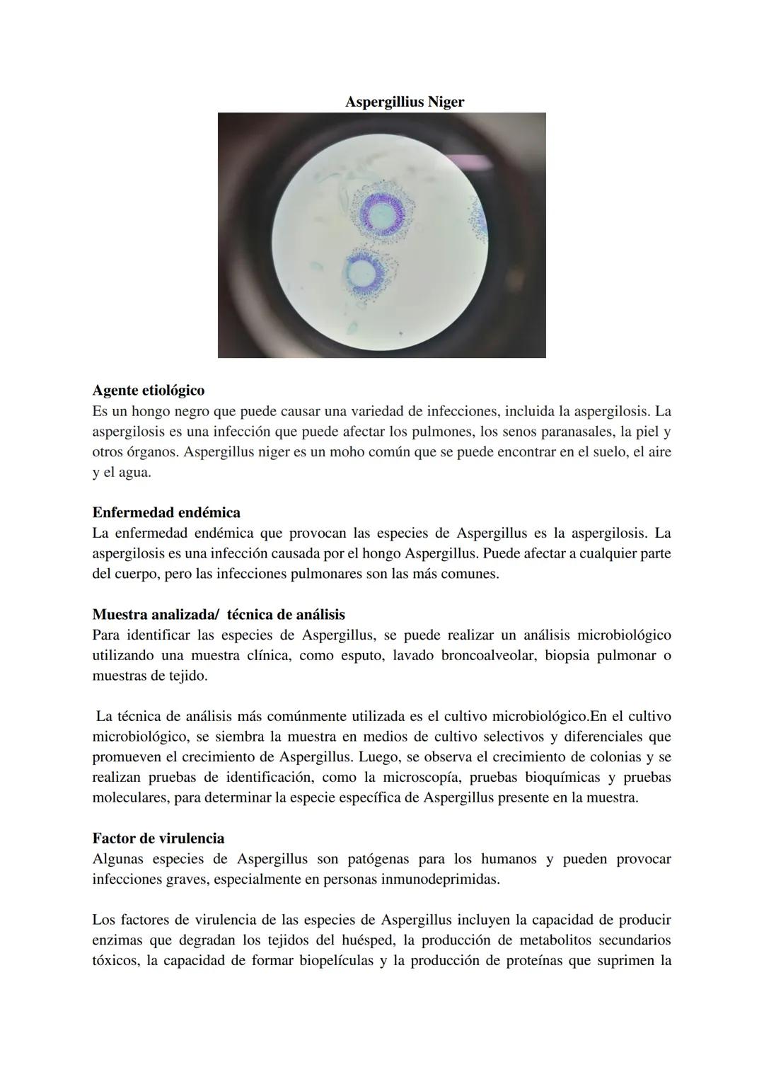 Dengue
1
Agente Etiológico
Es un virus de la familia Flaviridae, género Flavivirus. Los virus del dengue son virus de ARN
pequeños, envuelto