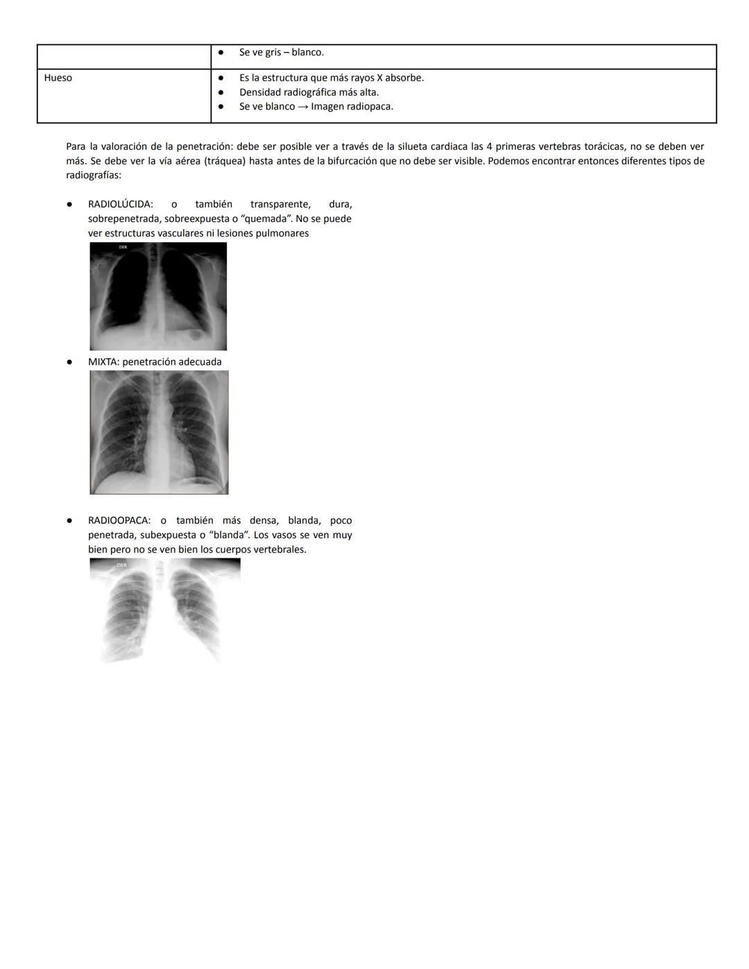 RADIOGRAFÍA DE TÓRAX
1.MJO
INTRODUCCION
La radiografía de tórax continúa siendo el método por imágenes más solicitado por los médicos clínic