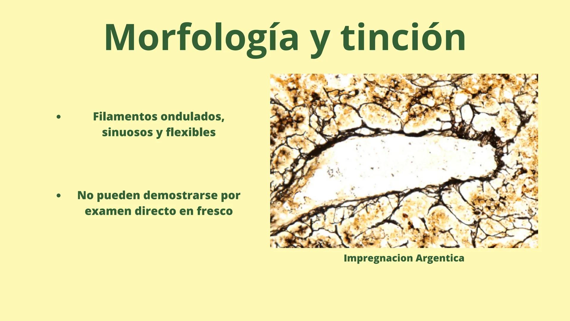 # MEMBRANA CELULAR

ESPACIO
EXTRACELULAR
(afuera de la célula)

Colesterol

CITOSOL
Proteínas
Un fosfolipido
Bicapa de
fosfolipidos
(adentro