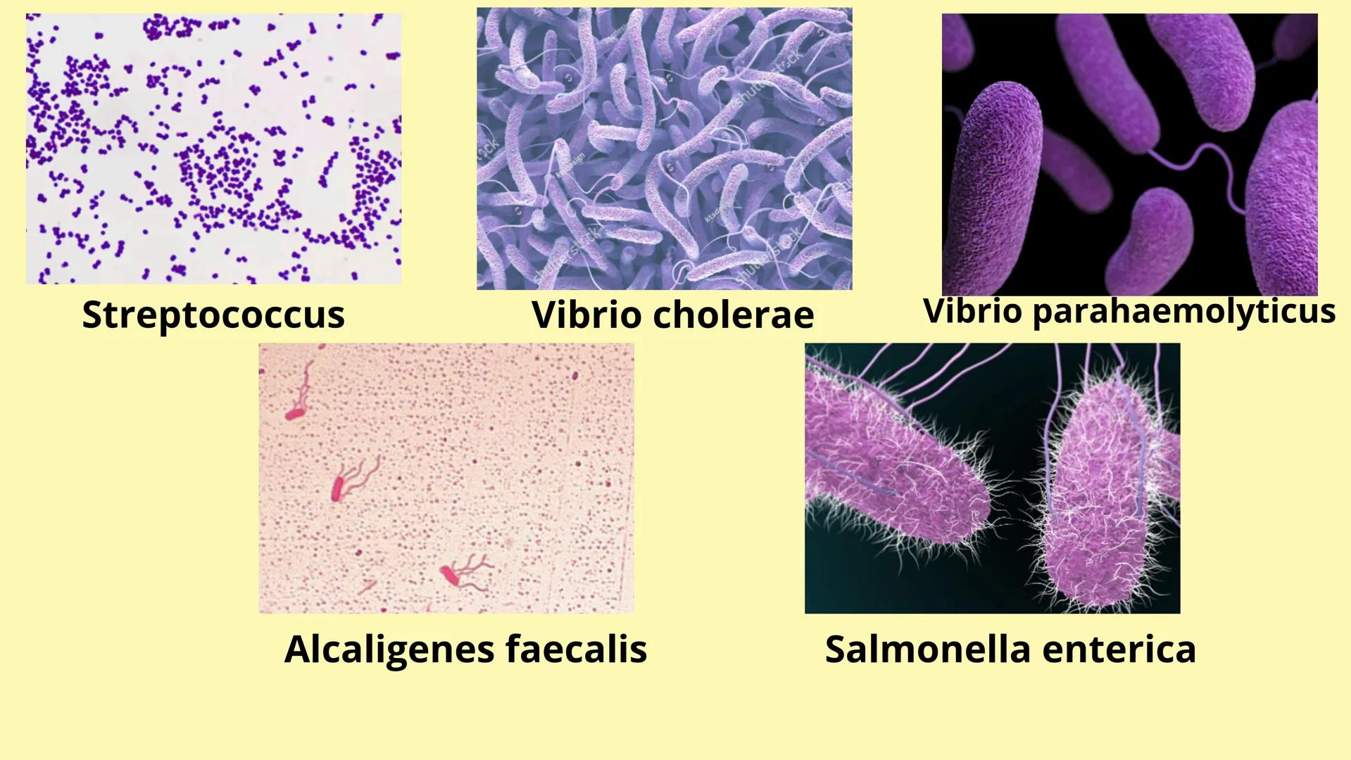 # MEMBRANA CELULAR

ESPACIO
EXTRACELULAR
(afuera de la célula)

Colesterol

CITOSOL
Proteínas
Un fosfolipido
Bicapa de
fosfolipidos
(adentro