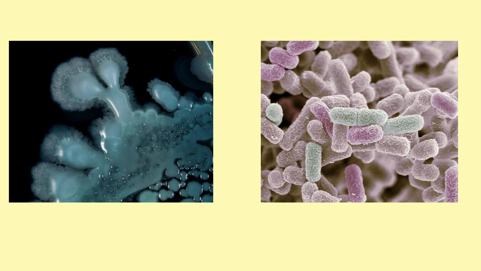 # MEMBRANA CELULAR

ESPACIO
EXTRACELULAR
(afuera de la célula)

Colesterol

CITOSOL
Proteínas
Un fosfolipido
Bicapa de
fosfolipidos
(adentro