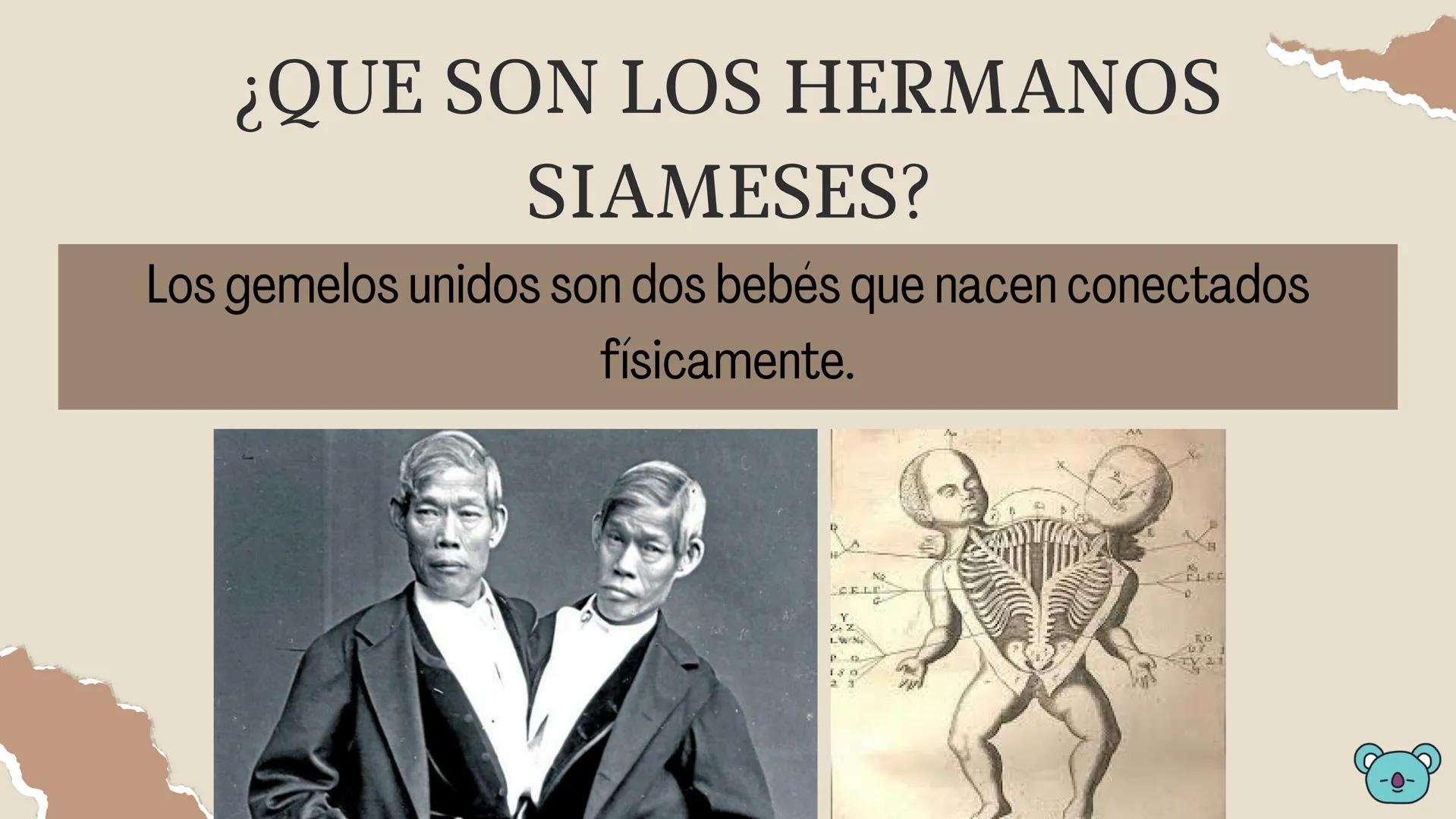 HERMANOS
SIAMESES
Septimo - 2022 ¿QUE SON LOS HERMANOS
SIAMESES?
Los gemelos unidos son dos bebés que nacen conectados
físicamente.
CELE
Y
2