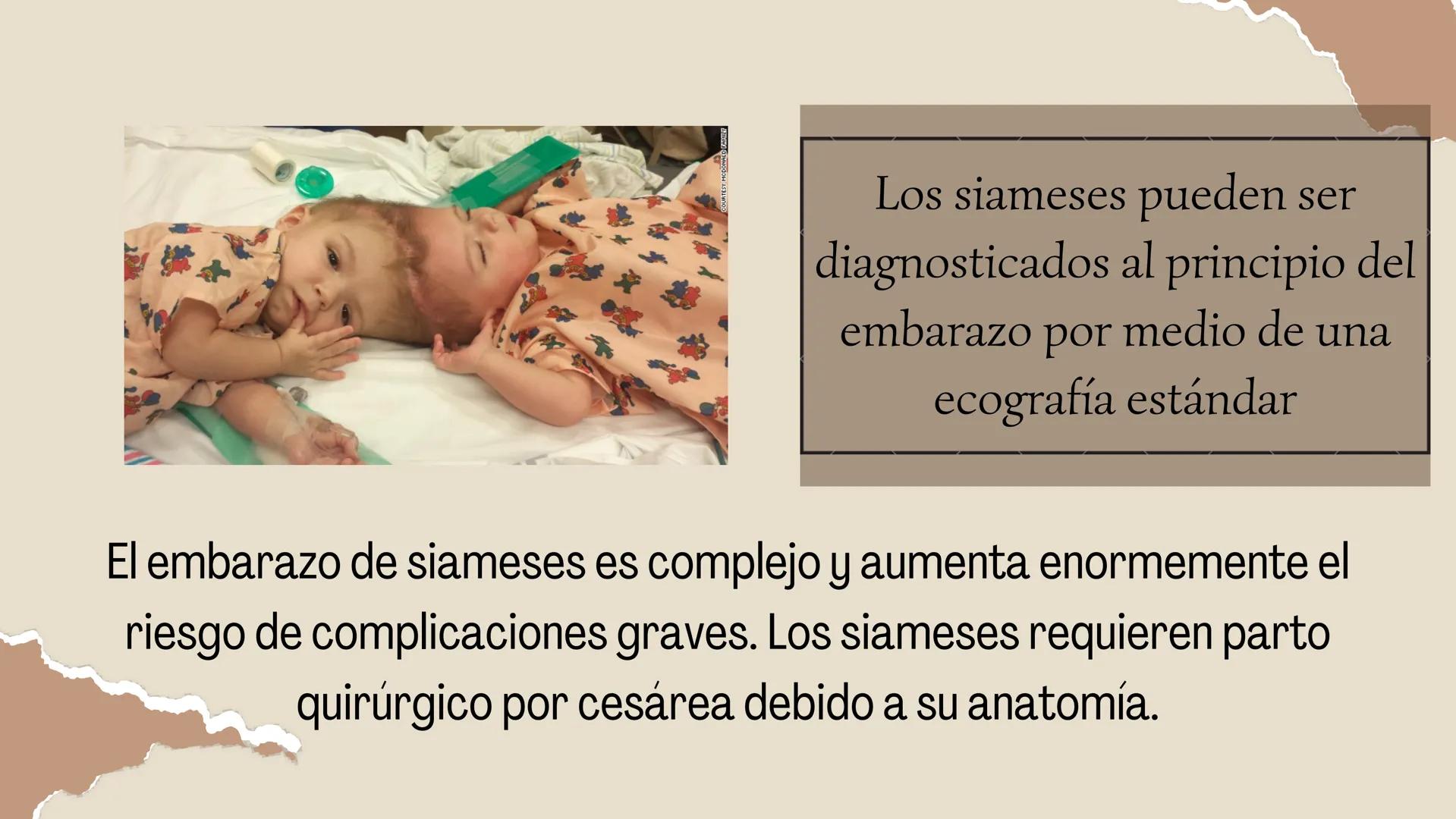 HERMANOS
SIAMESES
Septimo - 2022 ¿QUE SON LOS HERMANOS
SIAMESES?
Los gemelos unidos son dos bebés que nacen conectados
físicamente.
CELE
Y
2