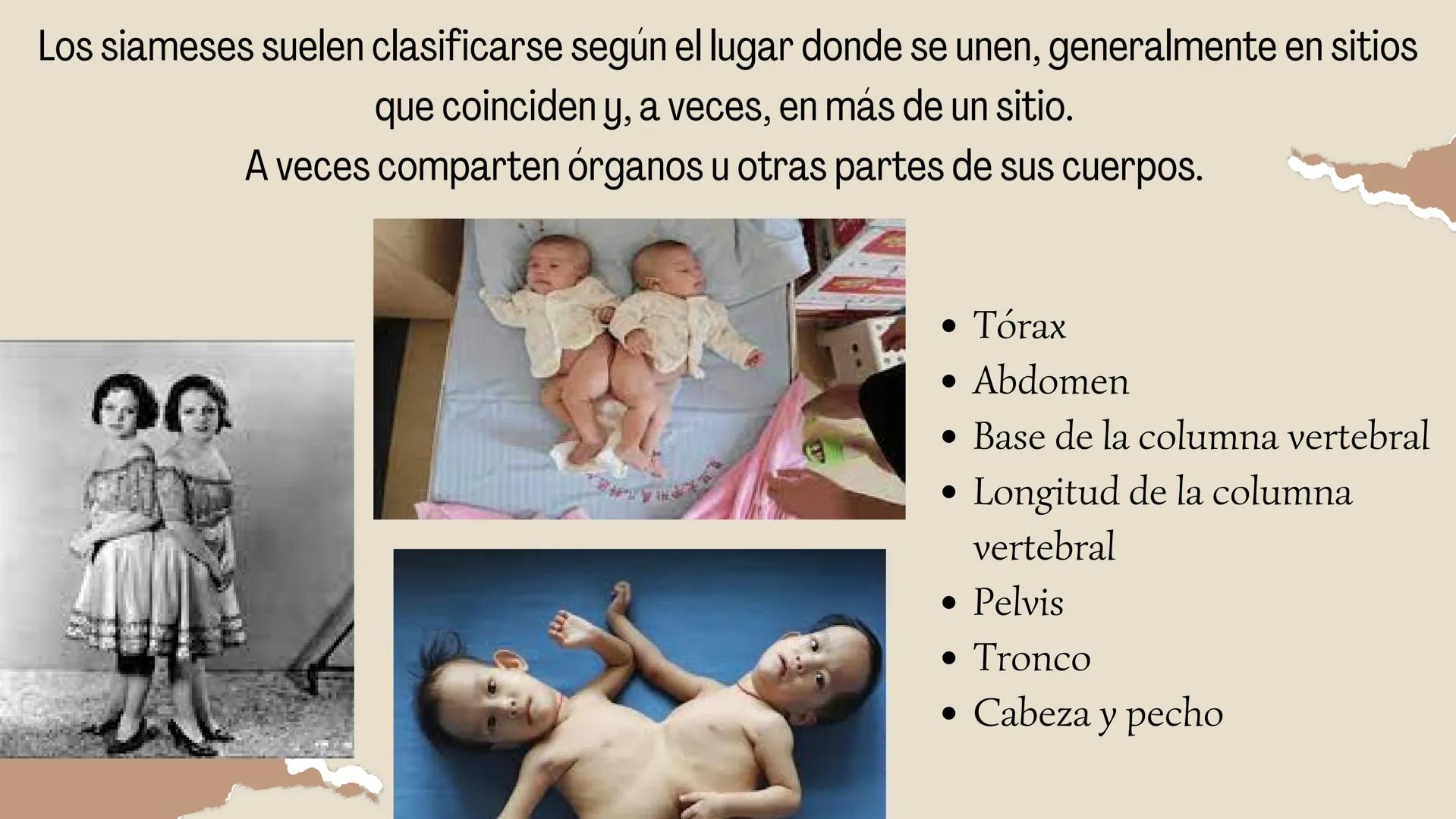 HERMANOS
SIAMESES
Septimo - 2022 ¿QUE SON LOS HERMANOS
SIAMESES?
Los gemelos unidos son dos bebés que nacen conectados
físicamente.
CELE
Y
2