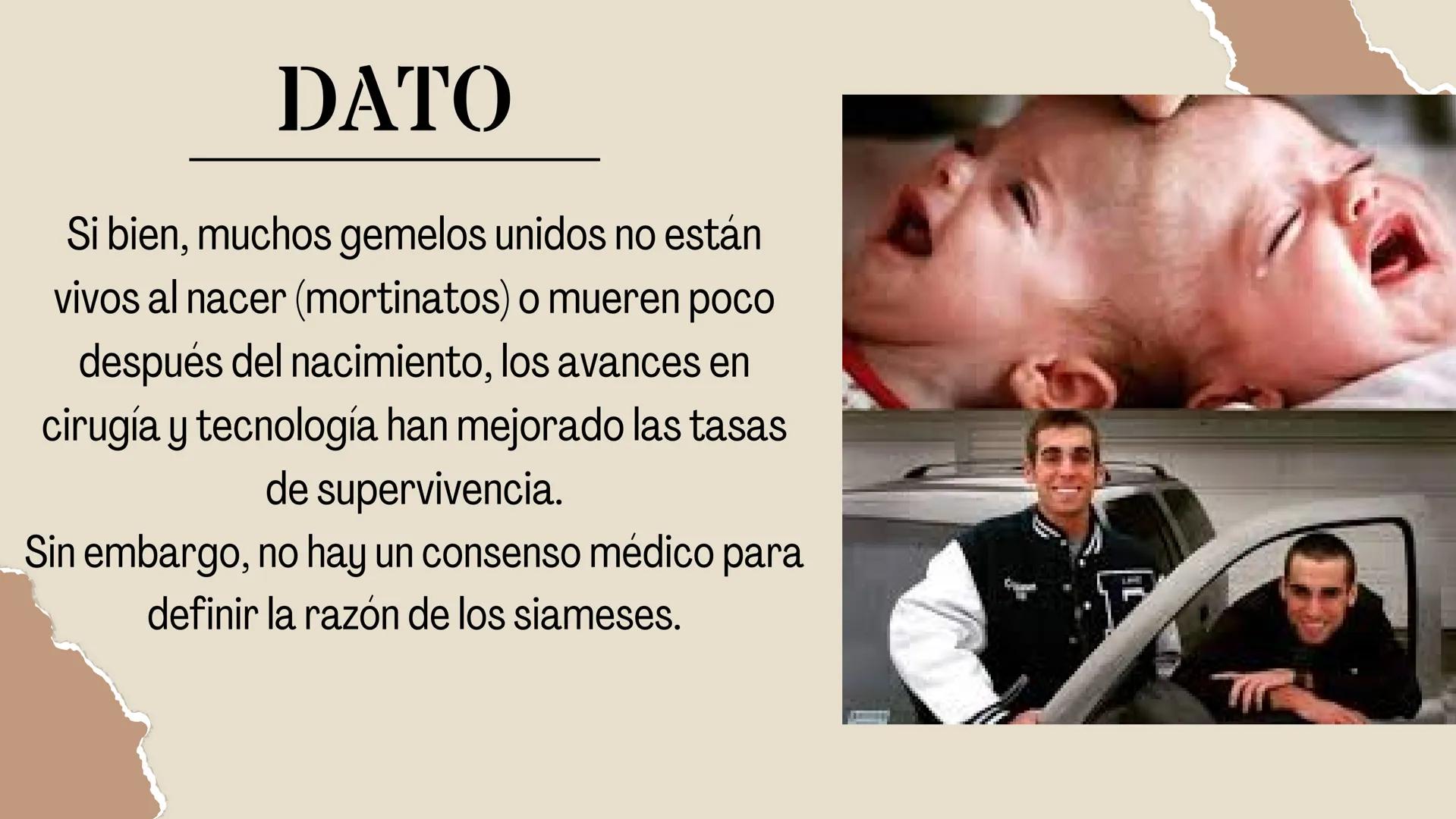 HERMANOS
SIAMESES
Septimo - 2022 ¿QUE SON LOS HERMANOS
SIAMESES?
Los gemelos unidos son dos bebés que nacen conectados
físicamente.
CELE
Y
2