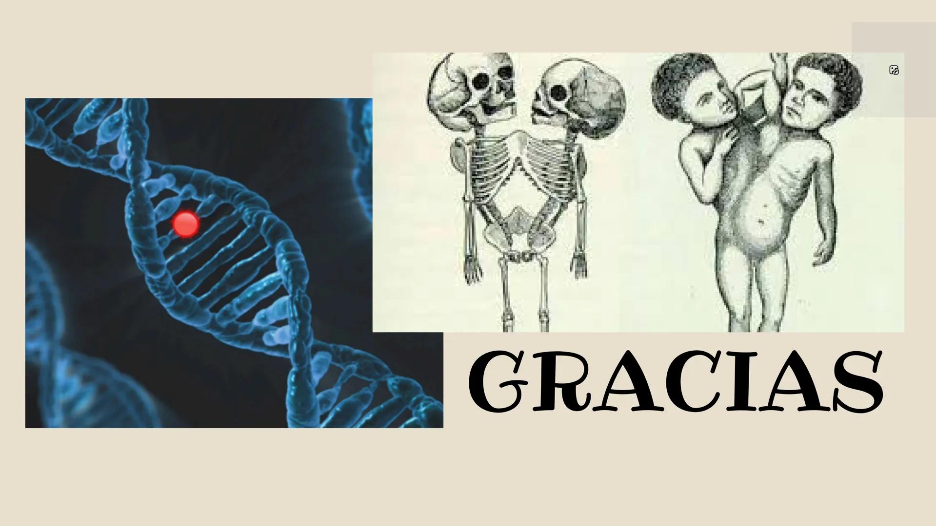 HERMANOS
SIAMESES
Septimo - 2022 ¿QUE SON LOS HERMANOS
SIAMESES?
Los gemelos unidos son dos bebés que nacen conectados
físicamente.
CELE
Y
2