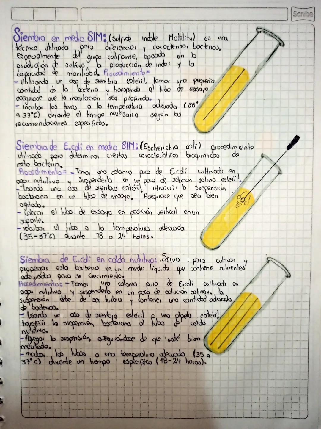 コ
C
コ
コ
コ
D
# Tipas De Siembra

Siembra por Estria: Es util poro dotene,
cobmas aislados de micicorganismos,, lo
que facilita ed estudio y c