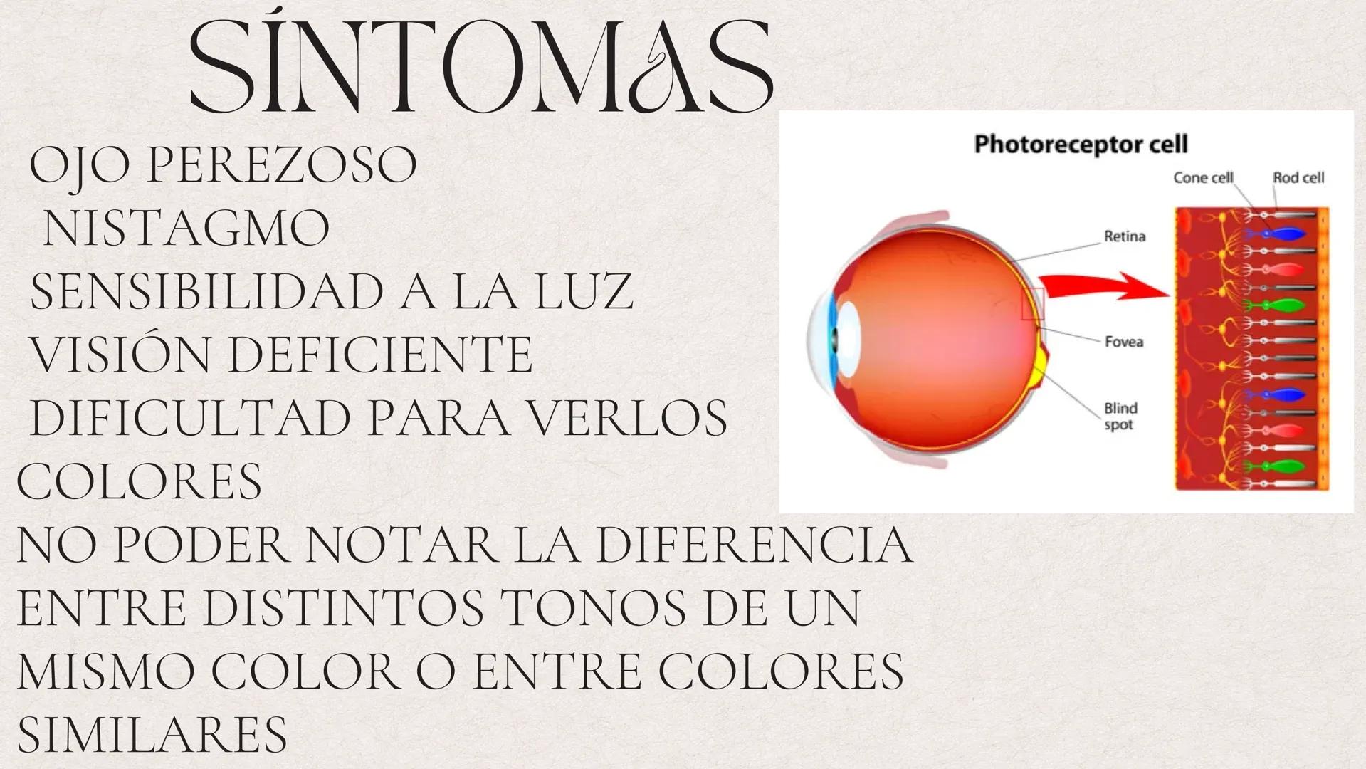 DALTONISMO ¿Origen o causas de la enfermedad.?
Si una persona carece solamente de un pigmento, podría
tener problemas para establecer la dif