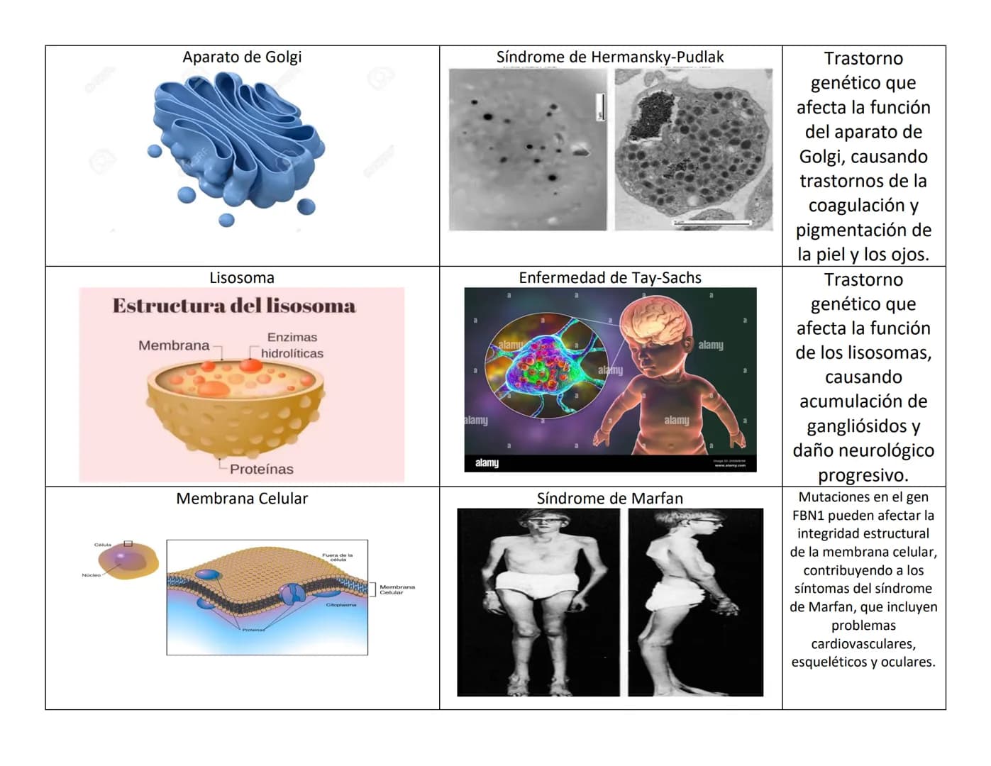 ORGANELO CELULAR
Mitocondria
ORGANESLOS CELULARES Y PATOLOGIAS
PATOLOGIA
Enfermedad de Leigh
Ribosomas
Espacio de
intermembrana
Matriz
Gránu