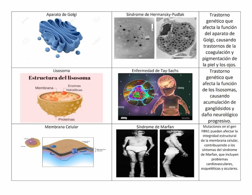 ORGANELO CELULAR
Mitocondria
ORGANESLOS CELULARES Y PATOLOGIAS
PATOLOGIA
Enfermedad de Leigh
Ribosomas
Espacio de
intermembrana
Matriz
Gránu