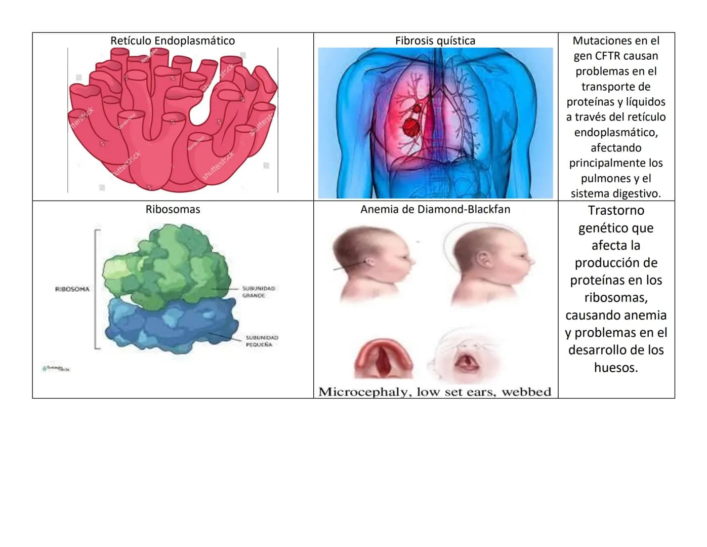 ORGANELO CELULAR
Mitocondria
ORGANESLOS CELULARES Y PATOLOGIAS
PATOLOGIA
Enfermedad de Leigh
Ribosomas
Espacio de
intermembrana
Matriz
Gránu