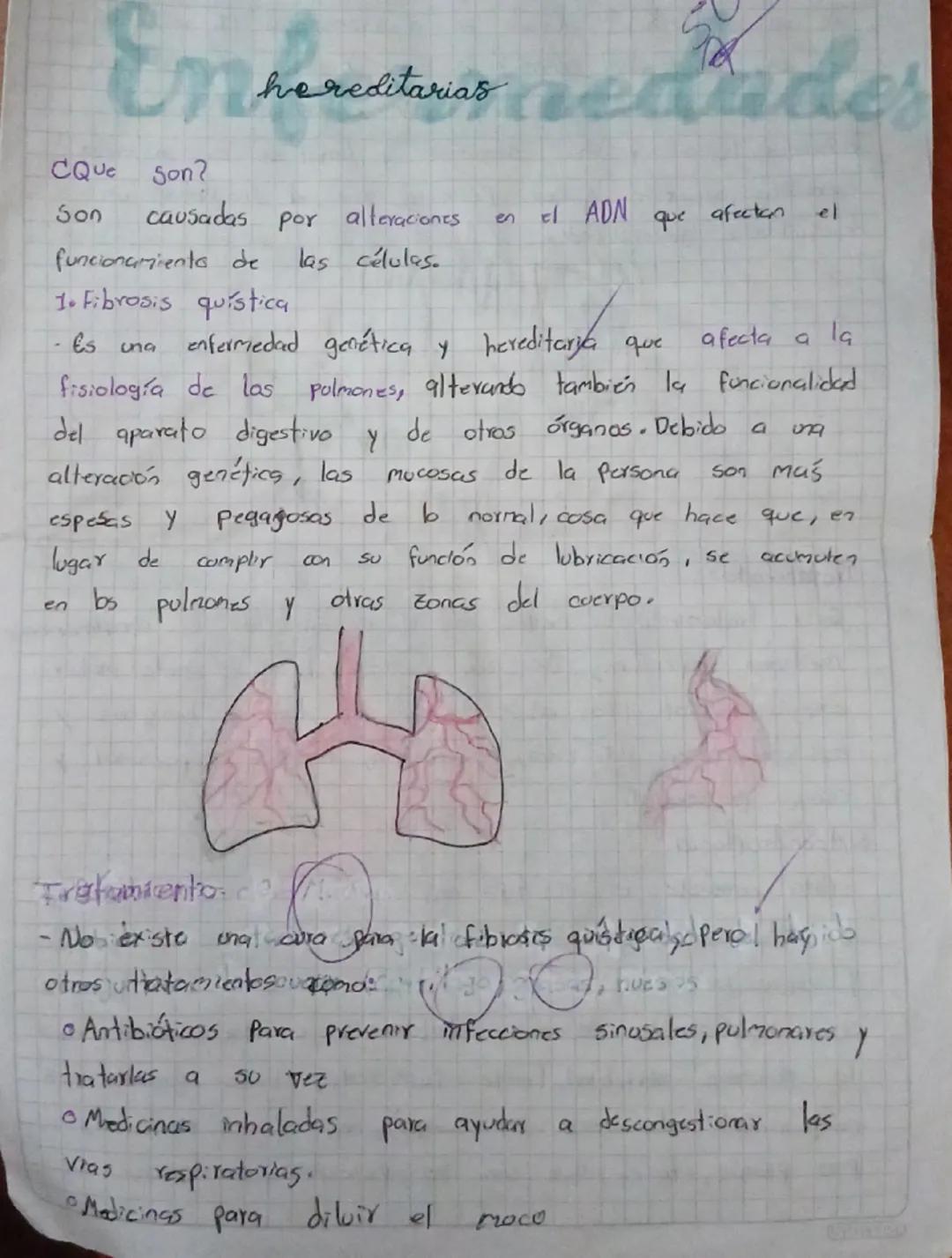 hereditariasader
CQue Son?
Son causadas por alteraciones en El ADN que afectan el
funcionamiento de las células.
1. Fibrosis quística
- Es u
