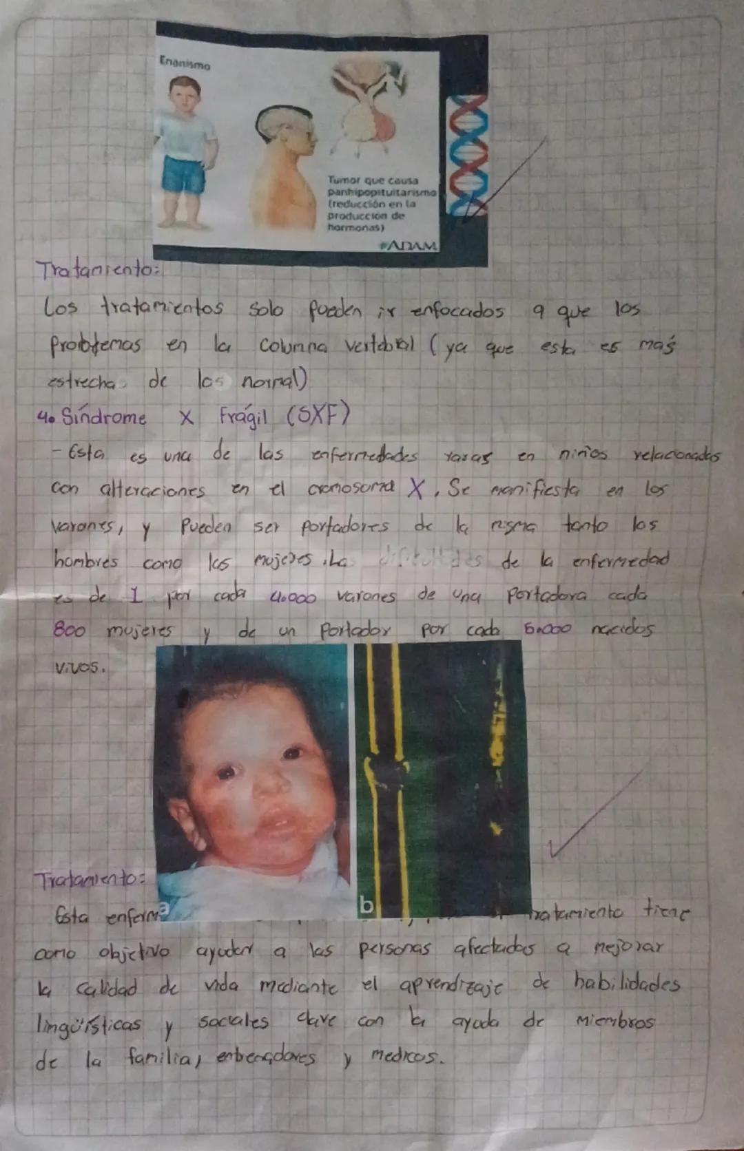 hereditariasader
CQue Son?
Son causadas por alteraciones en El ADN que afectan el
funcionamiento de las células.
1. Fibrosis quística
- Es u