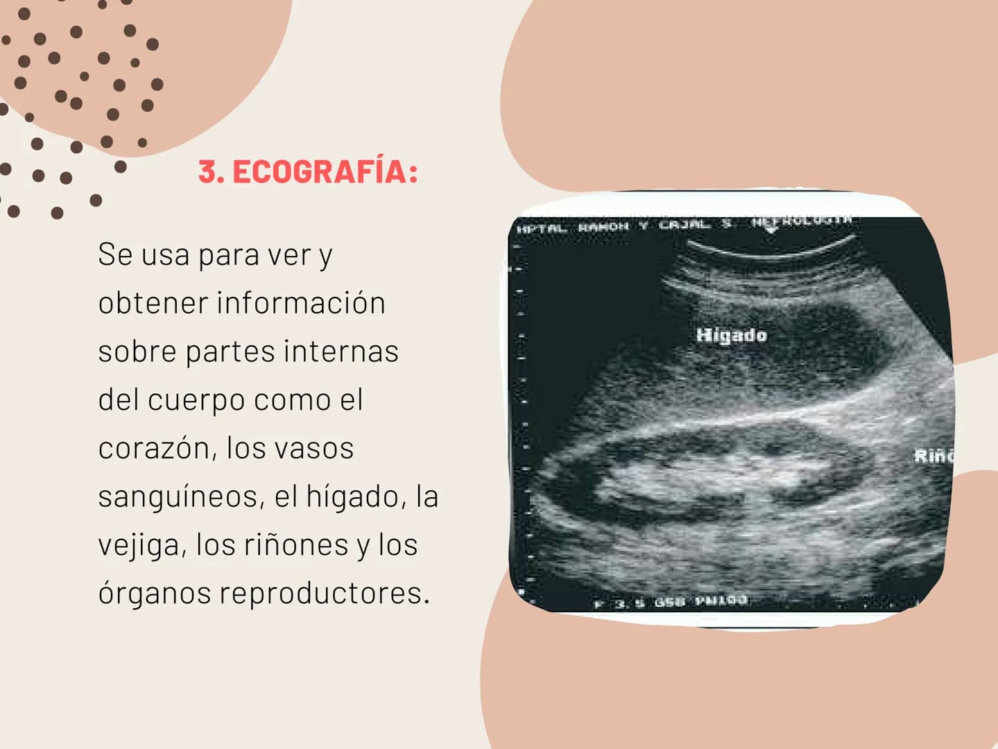 INSUFICIENCIA
RENAL EN
FELINOS INSUFICIENCIA
RENAL AGUDA METODOS FÍSICOS
INSPECCIÓN Y PALPACIÓN ...
• Evitar la palpación abdominal, ya que
