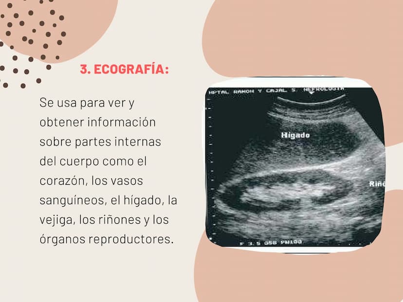 INSUFICIENCIA
RENAL EN
FELINOS INSUFICIENCIA
RENAL AGUDA METODOS FÍSICOS
INSPECCIÓN Y PALPACIÓN ...
• Evitar la palpación abdominal, ya que
