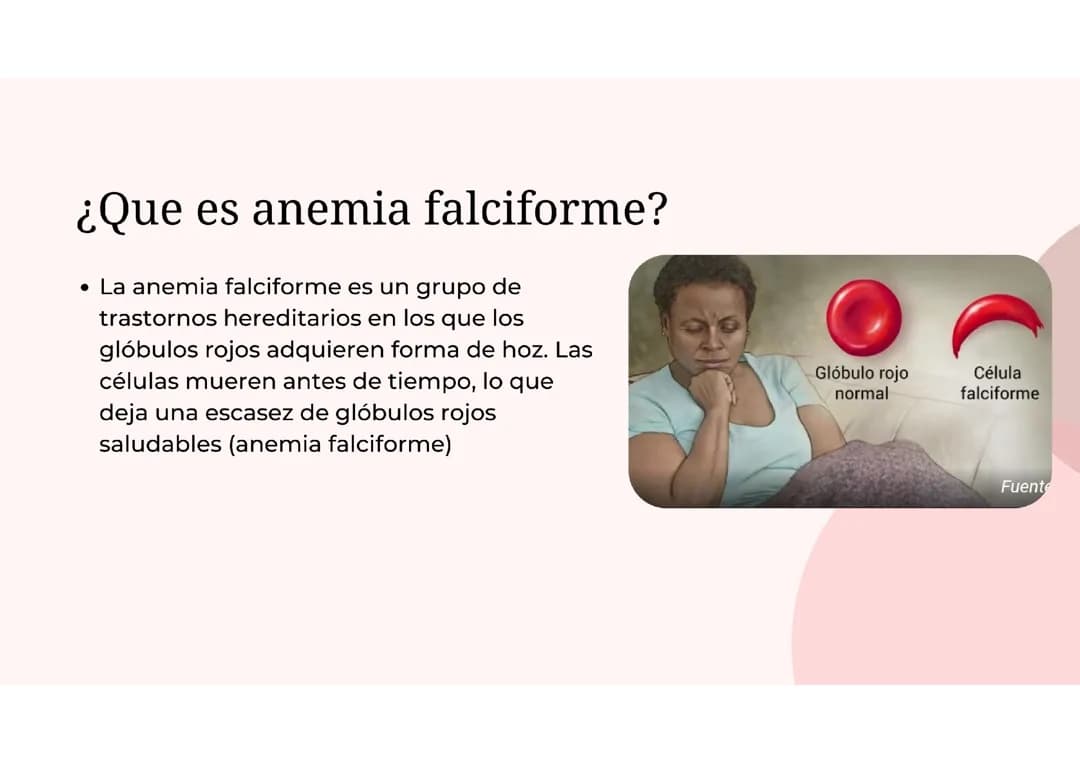 Anemia falciforme 