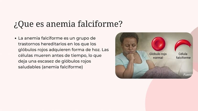 ¿Que es anemia falciforme?
• La anemia falciforme es un grupo de
trastornos hereditarios en los que los
glóbulos rojos adquieren forma de ho