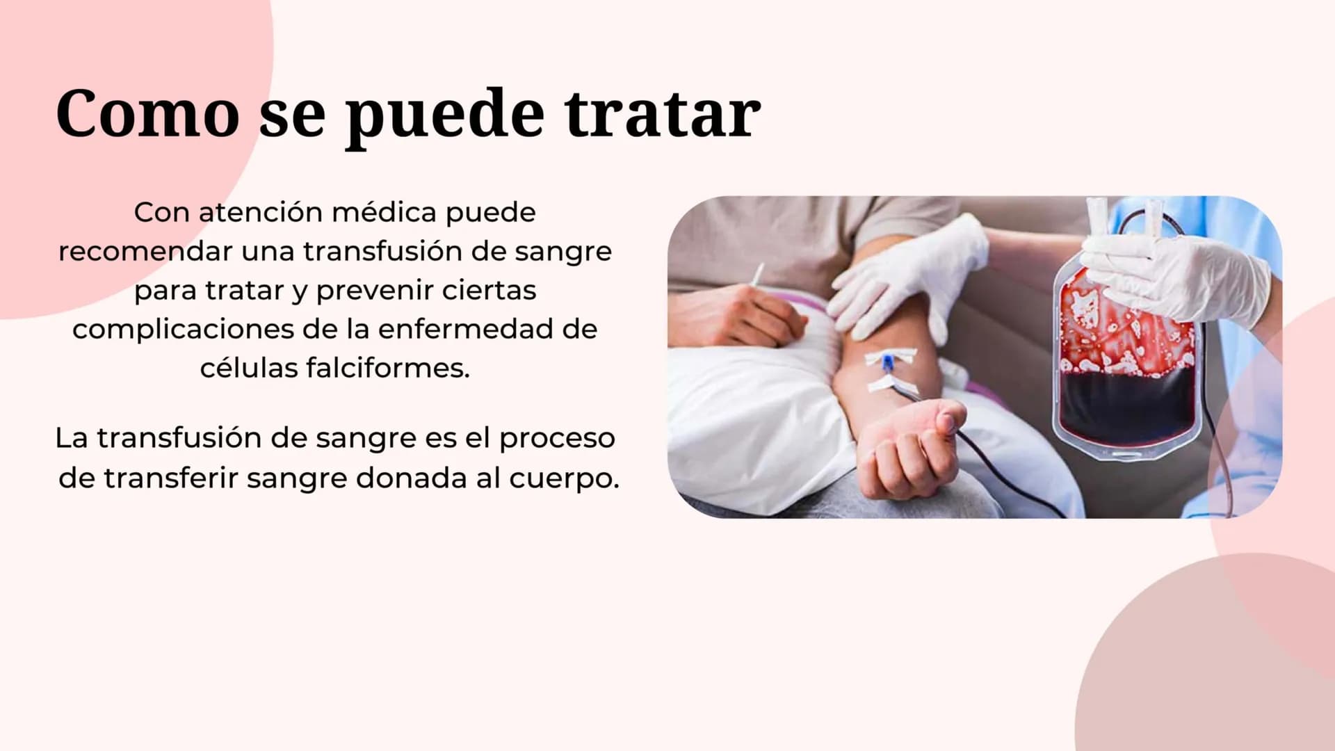¿Que es anemia falciforme?
• La anemia falciforme es un grupo de
trastornos hereditarios en los que los
glóbulos rojos adquieren forma de ho