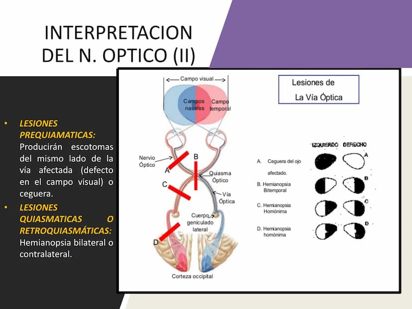 PARES CRANEALES
Existen 12 pares de nervios
craneales que salen del
cerebro y pasan a través de
emergencia
fisuras y orificios del cráneo
ex