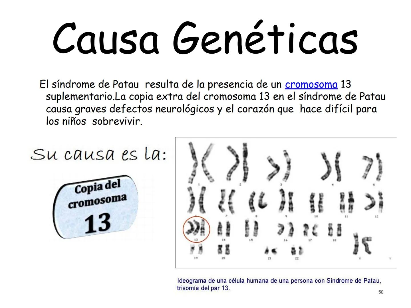 ¿Que es el Síndrome
de Patau?
El síndrome de Patau, también conocido como trisomia en
el par 13, trisomia D'o síndrome de Bartholin-Patau, e