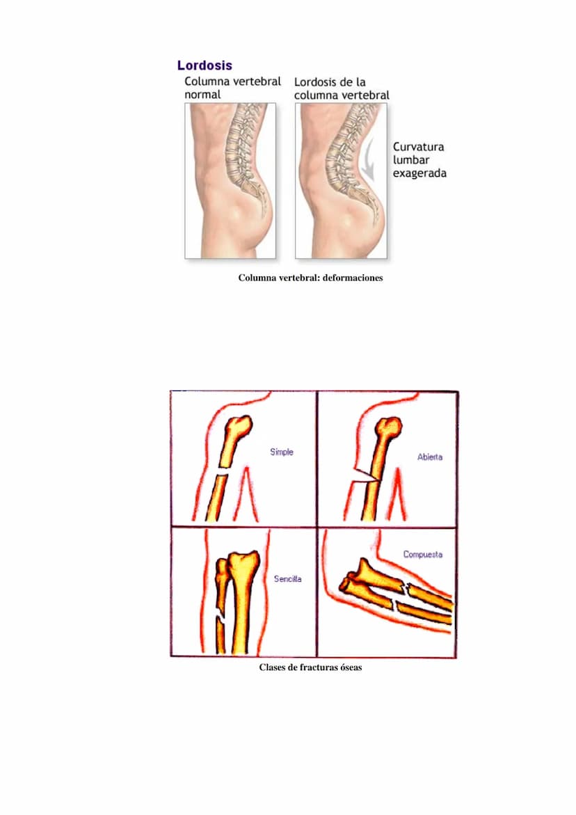 SISTEMA ESQUELÉTICO: FUNCIONES. HUESOS: ESTRUCTURA Y CLASIFICACIÓN.
HISTOLOGÍA DEL TEJIDO ÓSEO: CÉLULAS, TEJIDO ÓSEO COMPACTO Y TEJIDO
ÓSEO 
