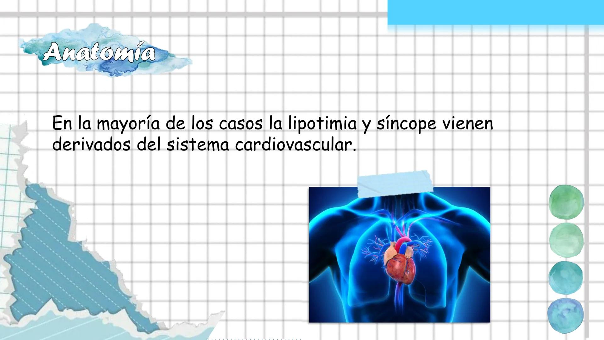 Lustica - Sincope Definición
Lipotimia
Es la perdida de conciencia pasajera
debido a una disminución de un flujo
sanguíneo cerebral.
Síncope