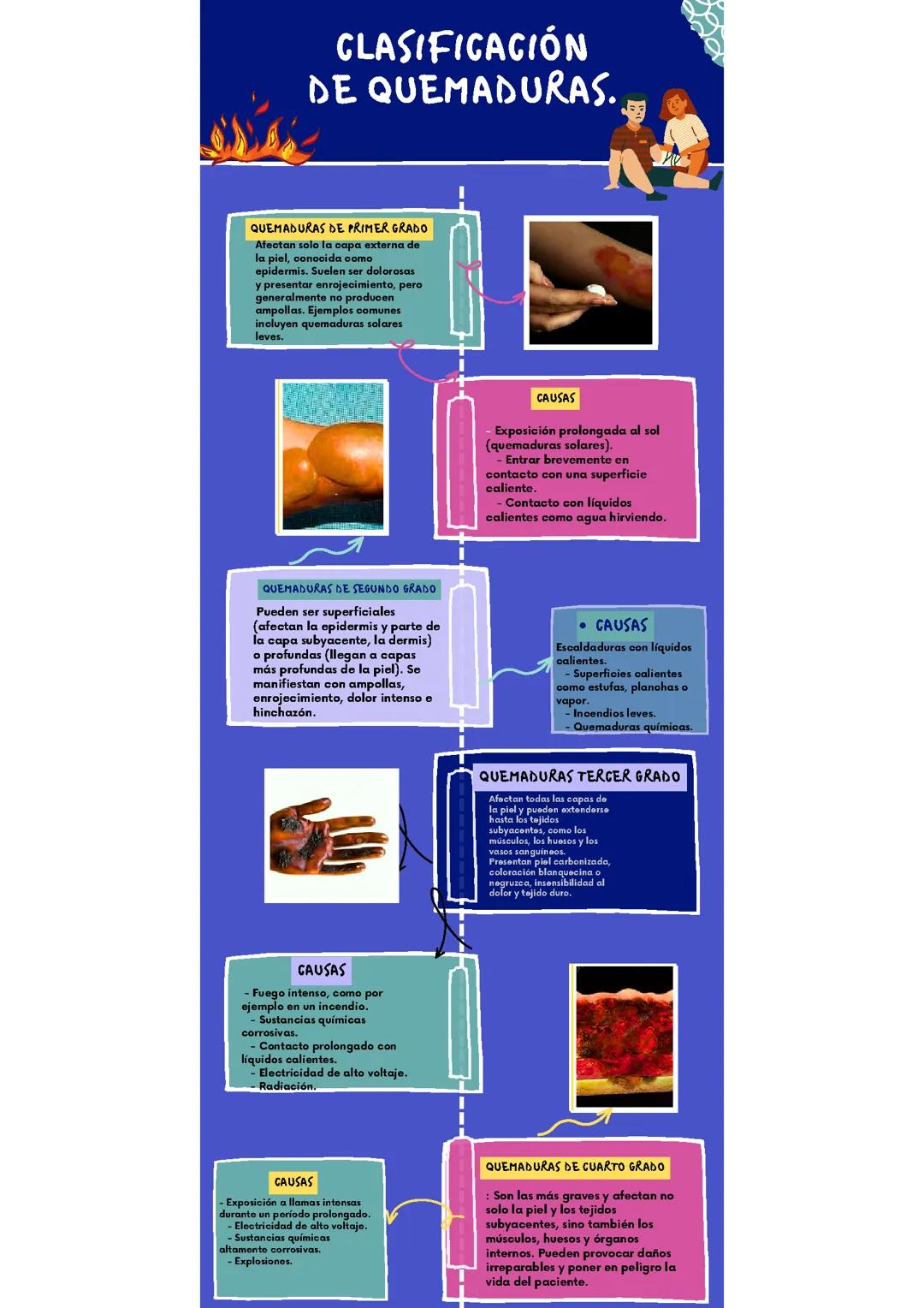 Clasificación de quemaduras 