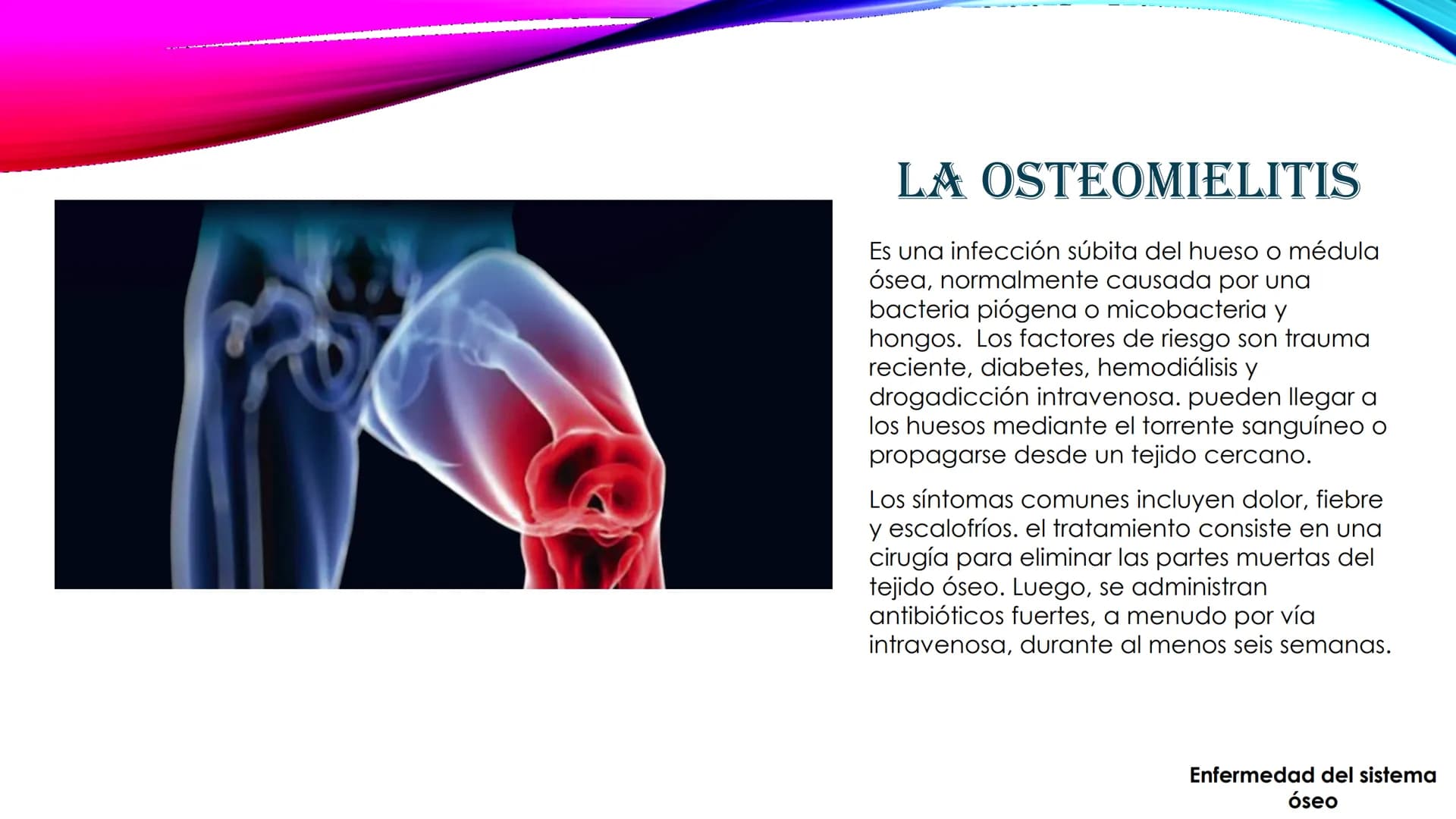 EL TEJIDO MUSCULAR
Músculos faciales
Esternocleidomastoideo
Trapecios
Clavicula
Deltoide
Pectorales
Biceps braquial.
Braquiorradial
Flexores