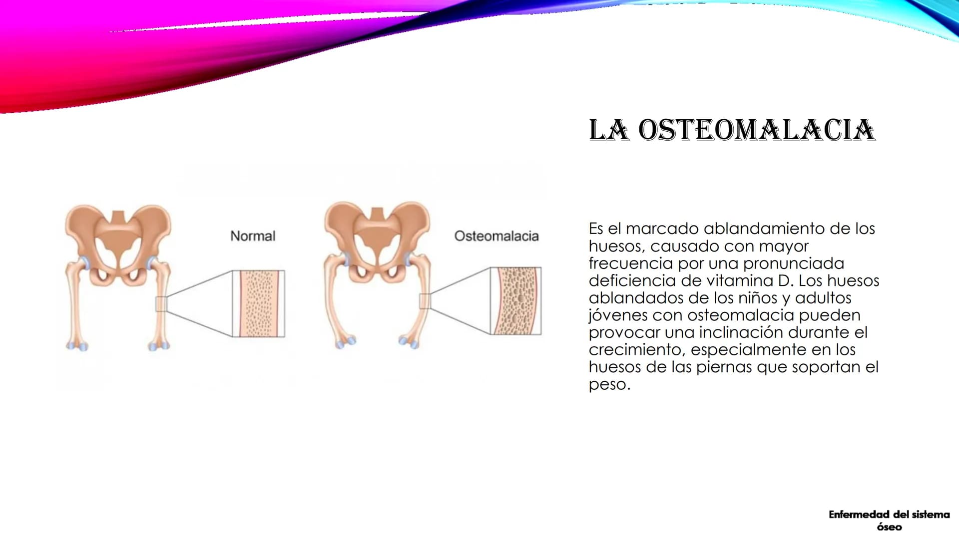 EL TEJIDO MUSCULAR
Músculos faciales
Esternocleidomastoideo
Trapecios
Clavicula
Deltoide
Pectorales
Biceps braquial.
Braquiorradial
Flexores