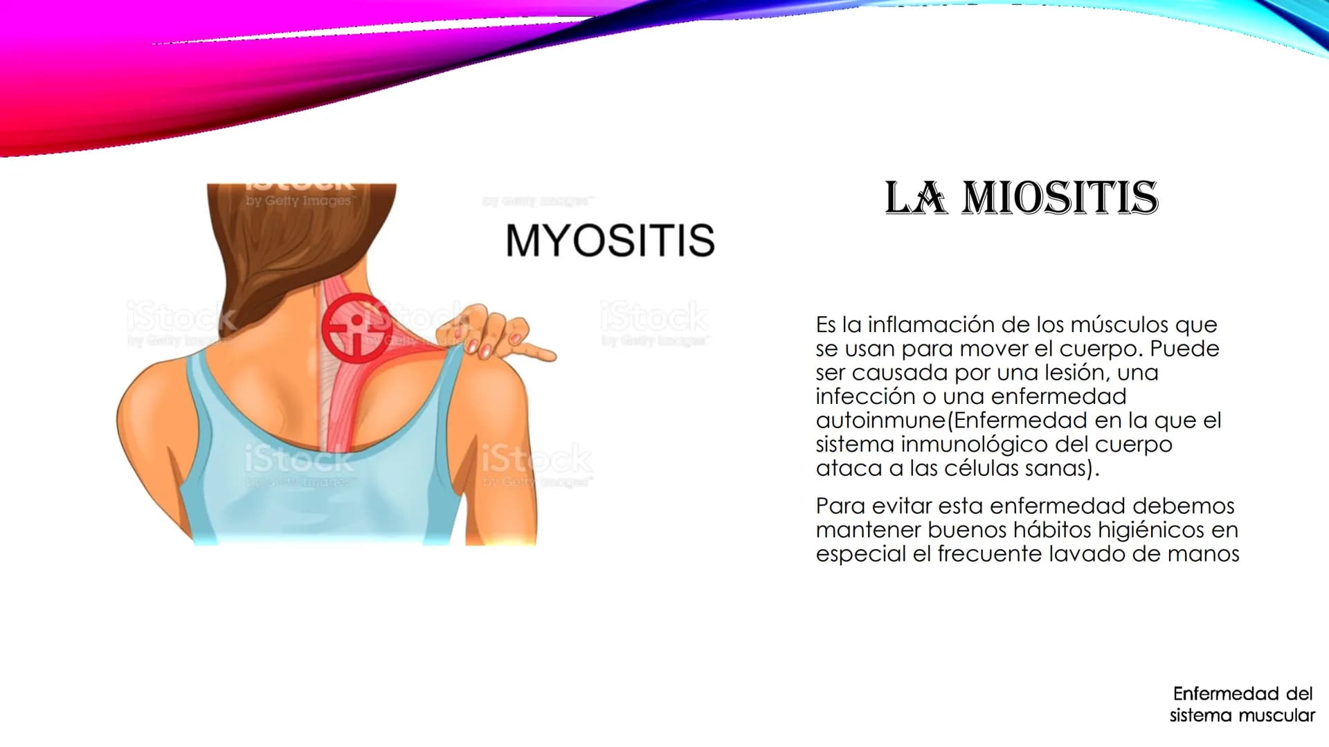 EL TEJIDO MUSCULAR
Músculos faciales
Esternocleidomastoideo
Trapecios
Clavicula
Deltoide
Pectorales
Biceps braquial.
Braquiorradial
Flexores