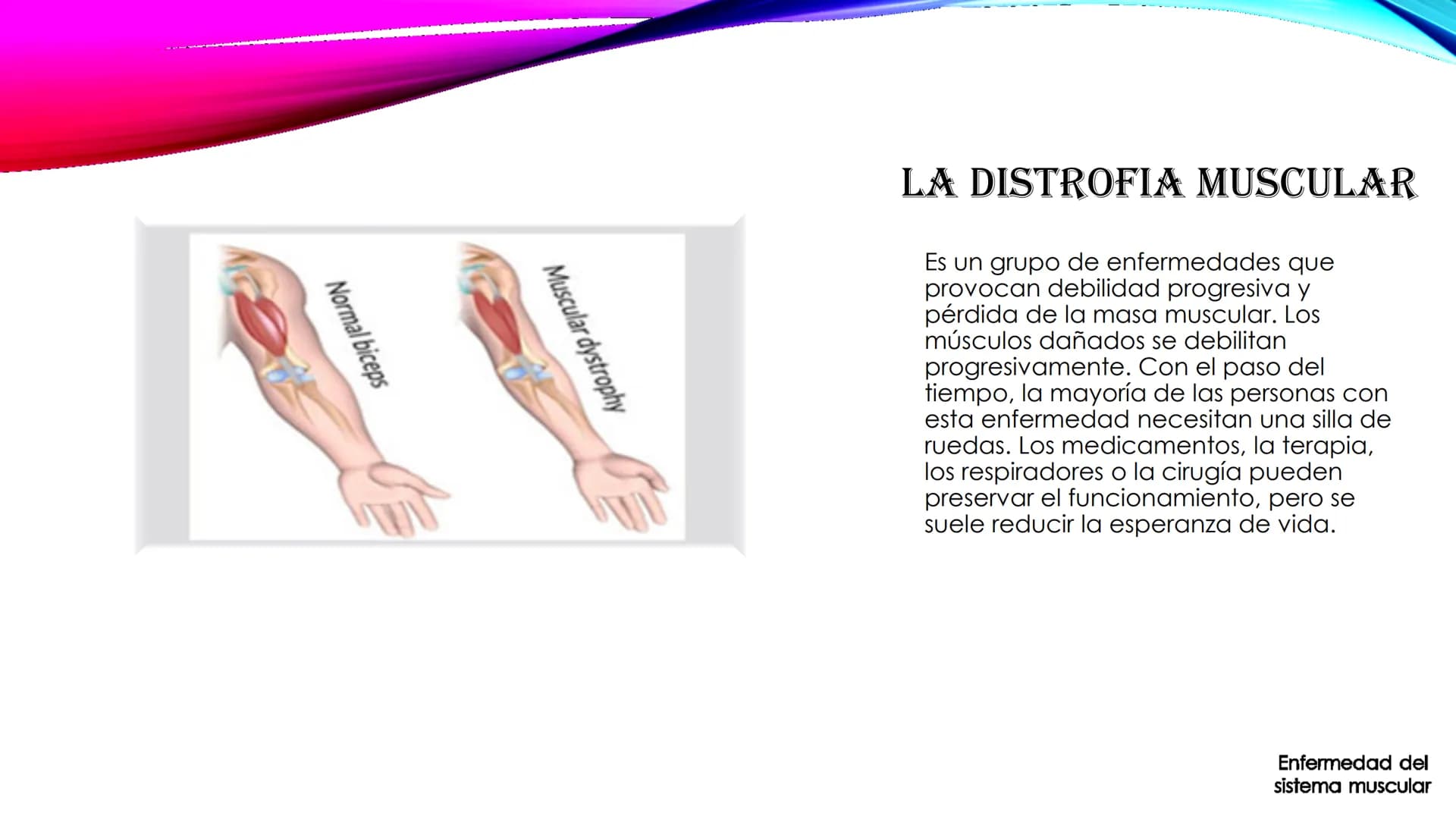 EL TEJIDO MUSCULAR
Músculos faciales
Esternocleidomastoideo
Trapecios
Clavicula
Deltoide
Pectorales
Biceps braquial.
Braquiorradial
Flexores