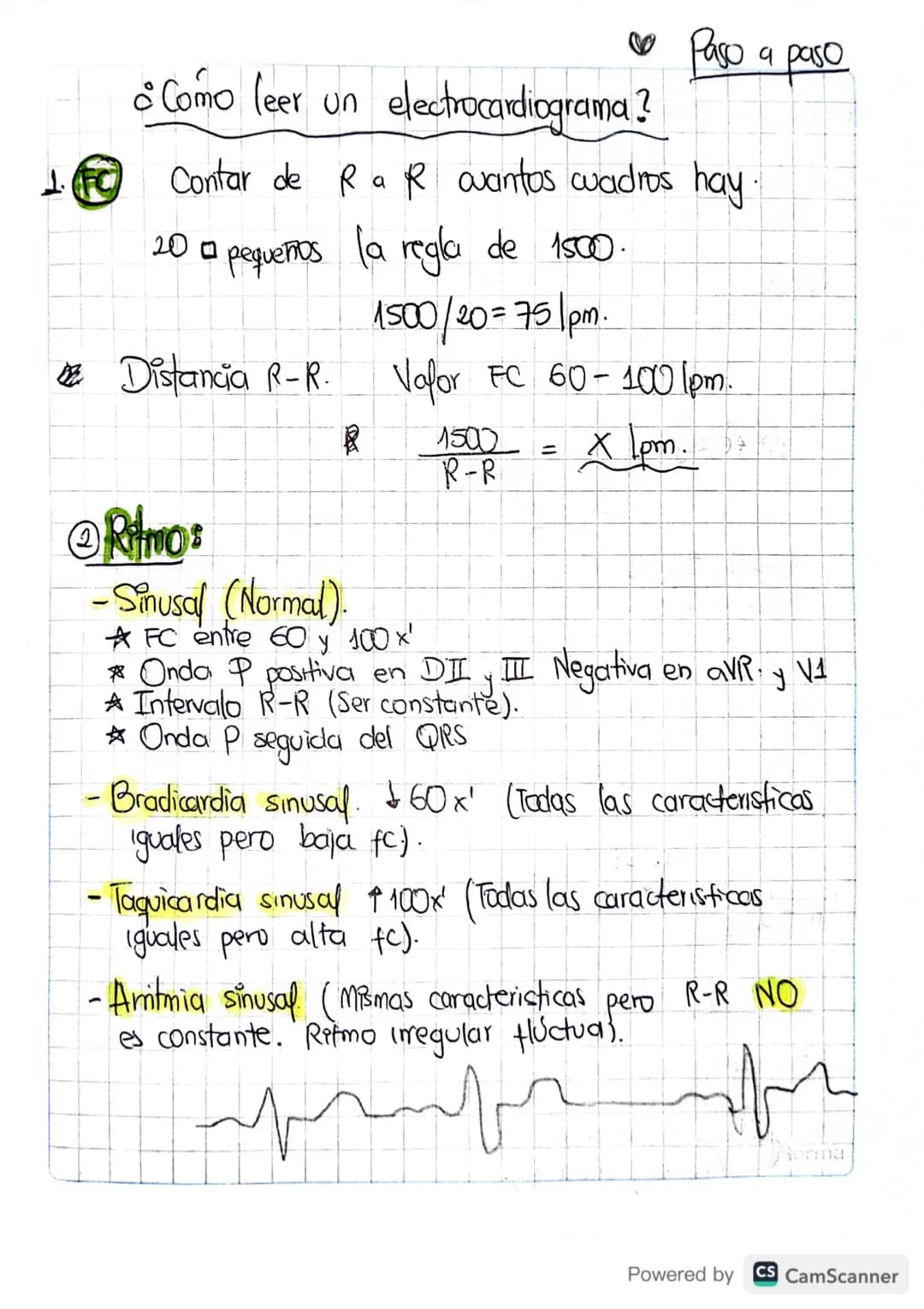 1. FC
• Paso a paso
• Como leer un electrocardiograma?
Contar de Ra R oantos cuadros hay.
20 pequeños la regla de 1500.
1500/20=751pm.
Valor