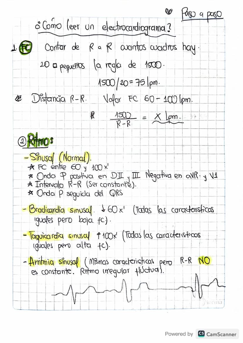 1. FC
• Paso a paso
• Como leer un electrocardiograma?
Contar de Ra R oantos cuadros hay.
20 pequeños la regla de 1500.
1500/20=751pm.
Valor