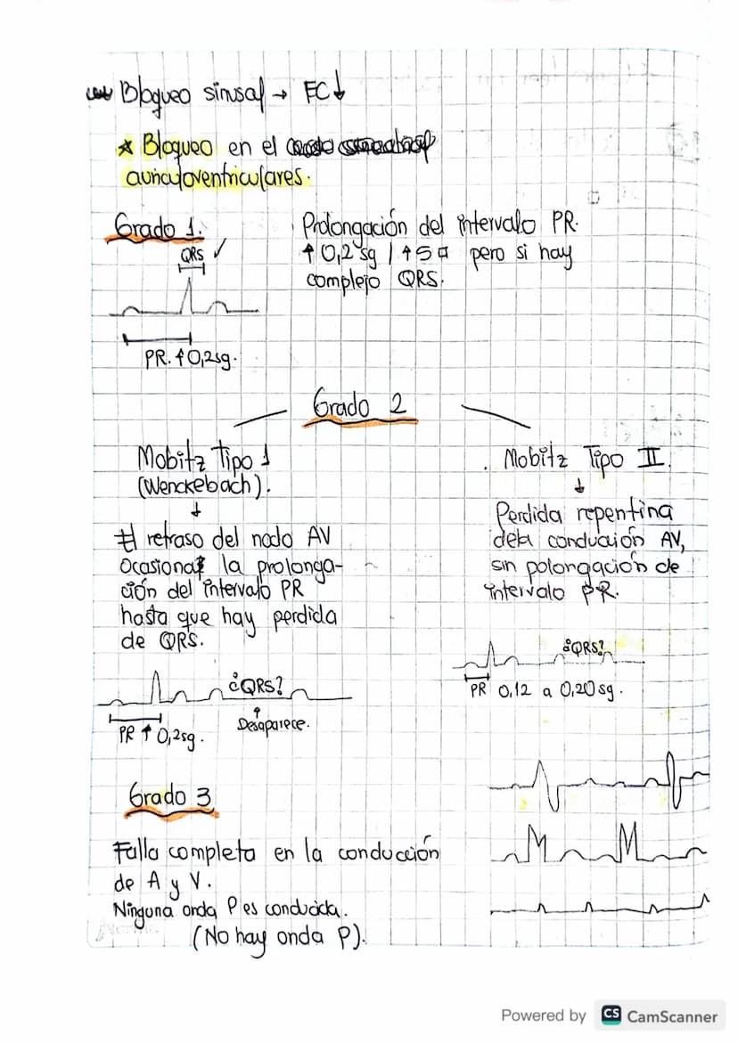 1. FC
• Paso a paso
• Como leer un electrocardiograma?
Contar de Ra R oantos cuadros hay.
20 pequeños la regla de 1500.
1500/20=751pm.
Valor